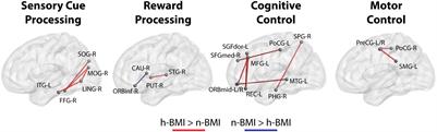 Maternal Adiposity Influences Neonatal Brain Functional Connectivity